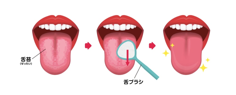 舌苔について 画像