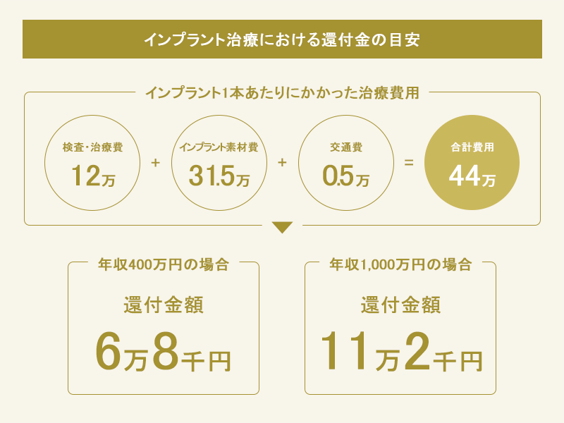 医療費控除によってインプラント治療時に還付される金額の例