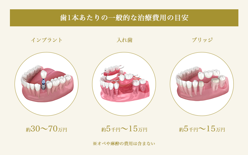 インプラントと入れ歯とブリッジの1本あたりの治療費用比較""