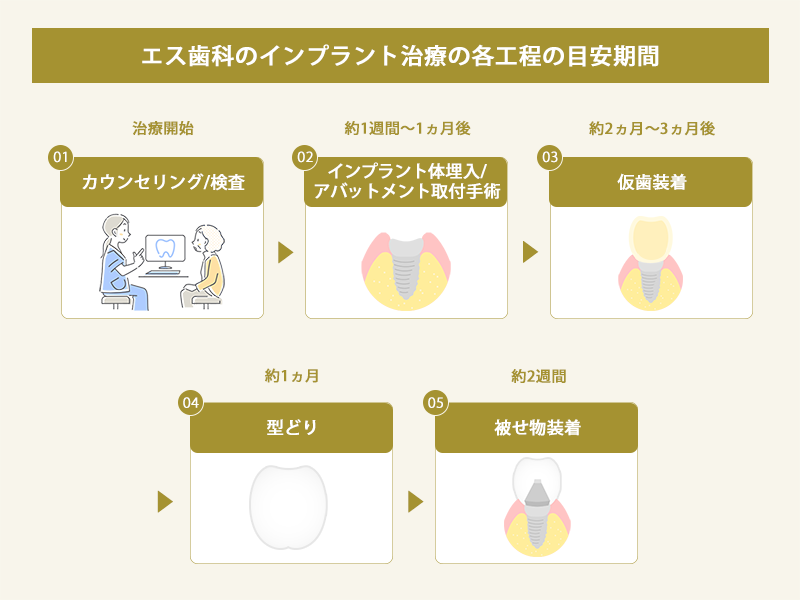 エス歯科のインプラント治療の流れ