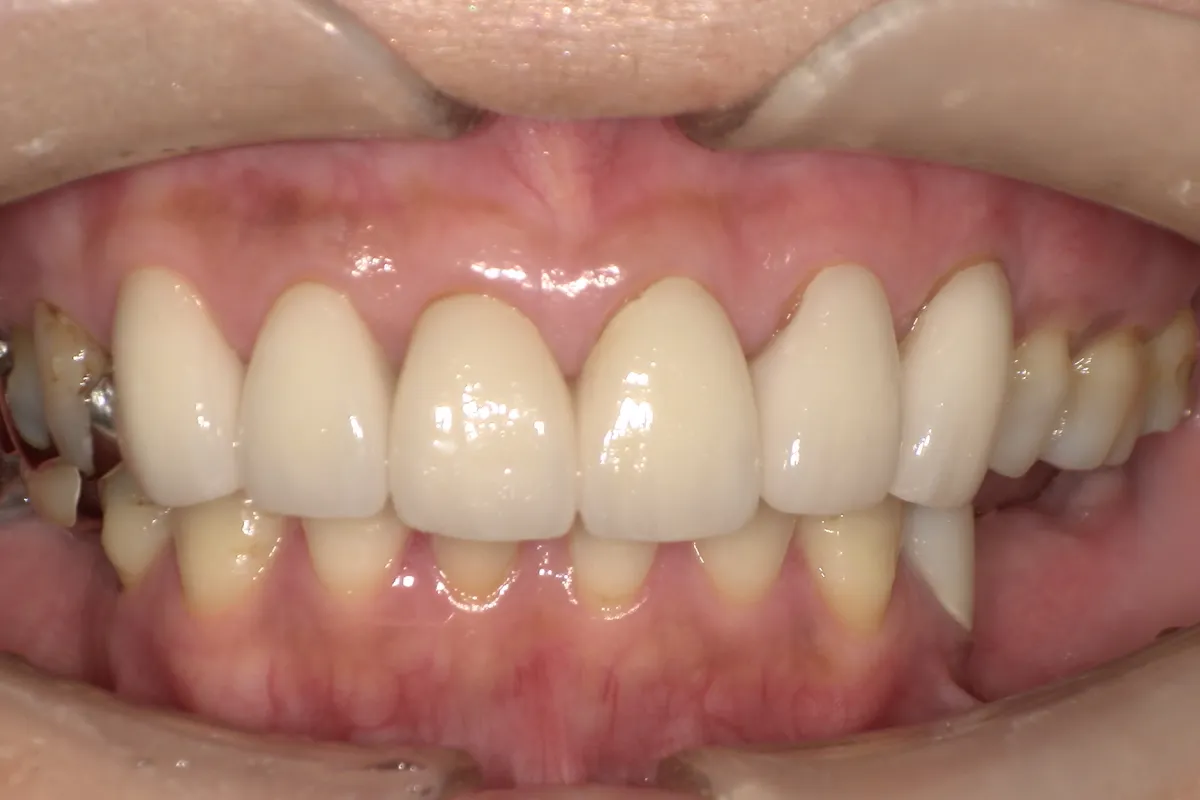 After Image