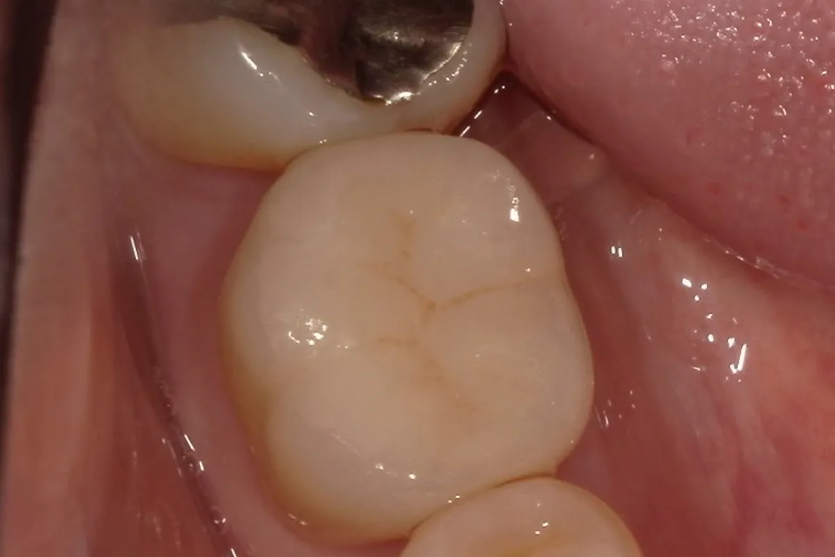 After Image