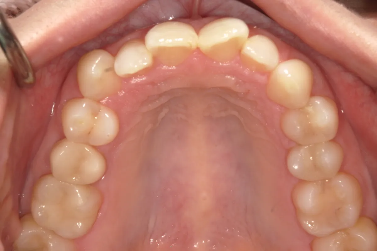 After Image