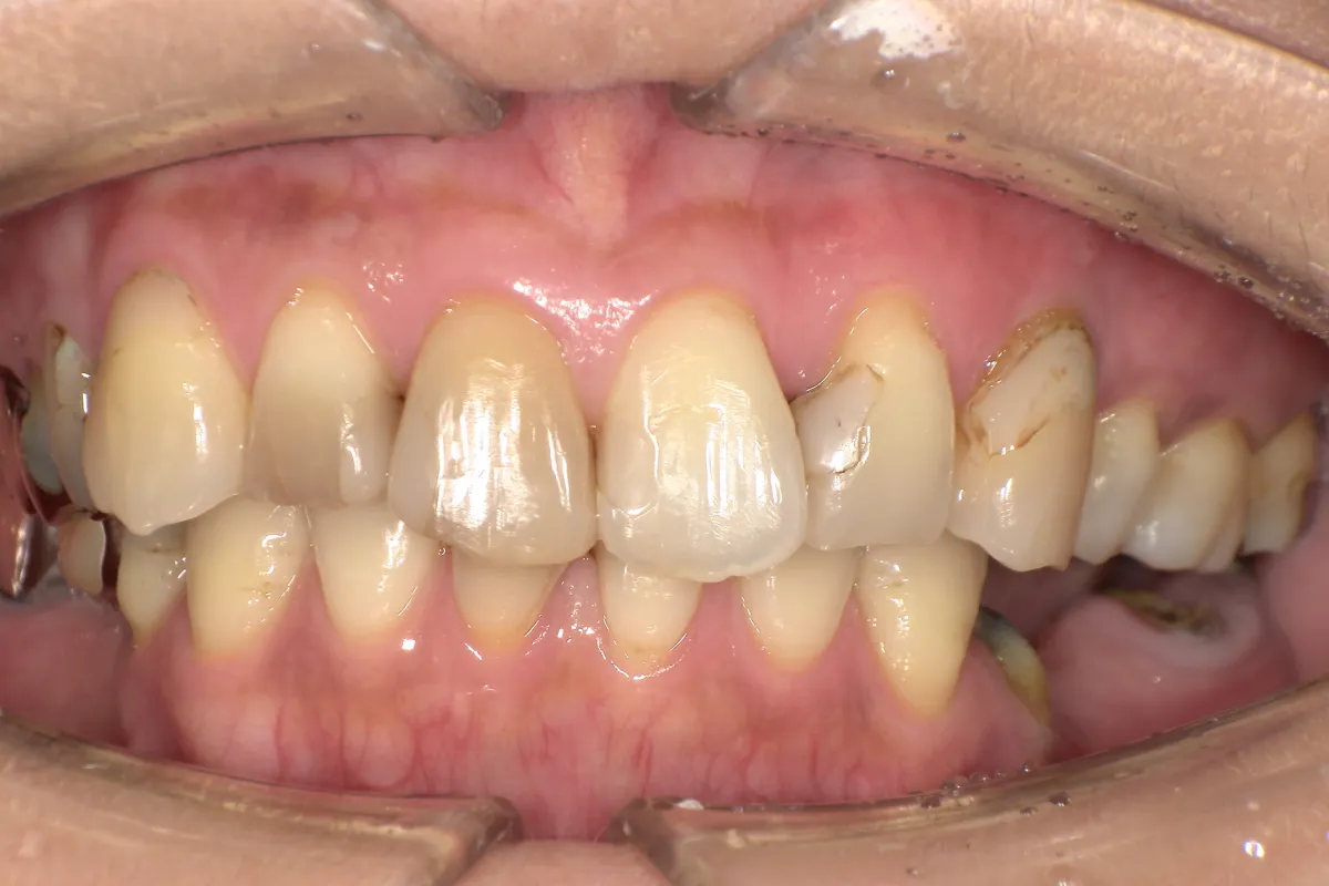Before Image
