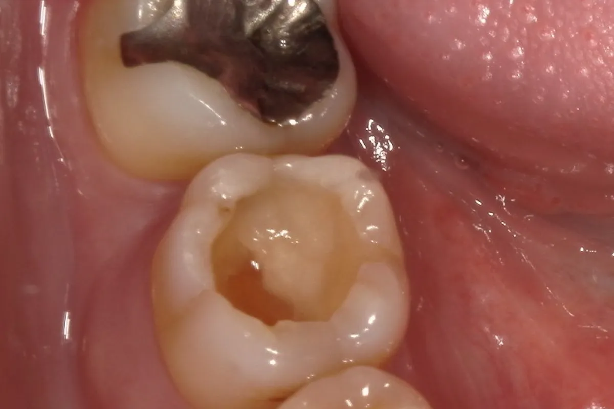 Before Image
