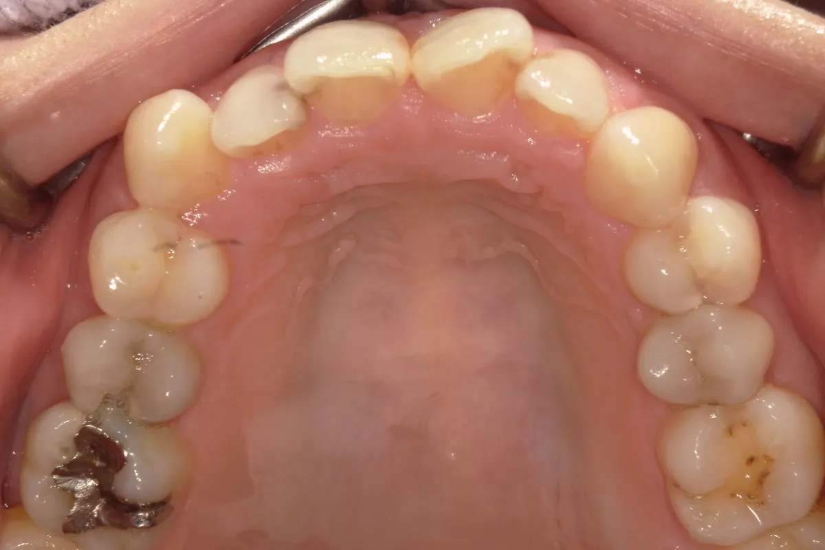 Before Image