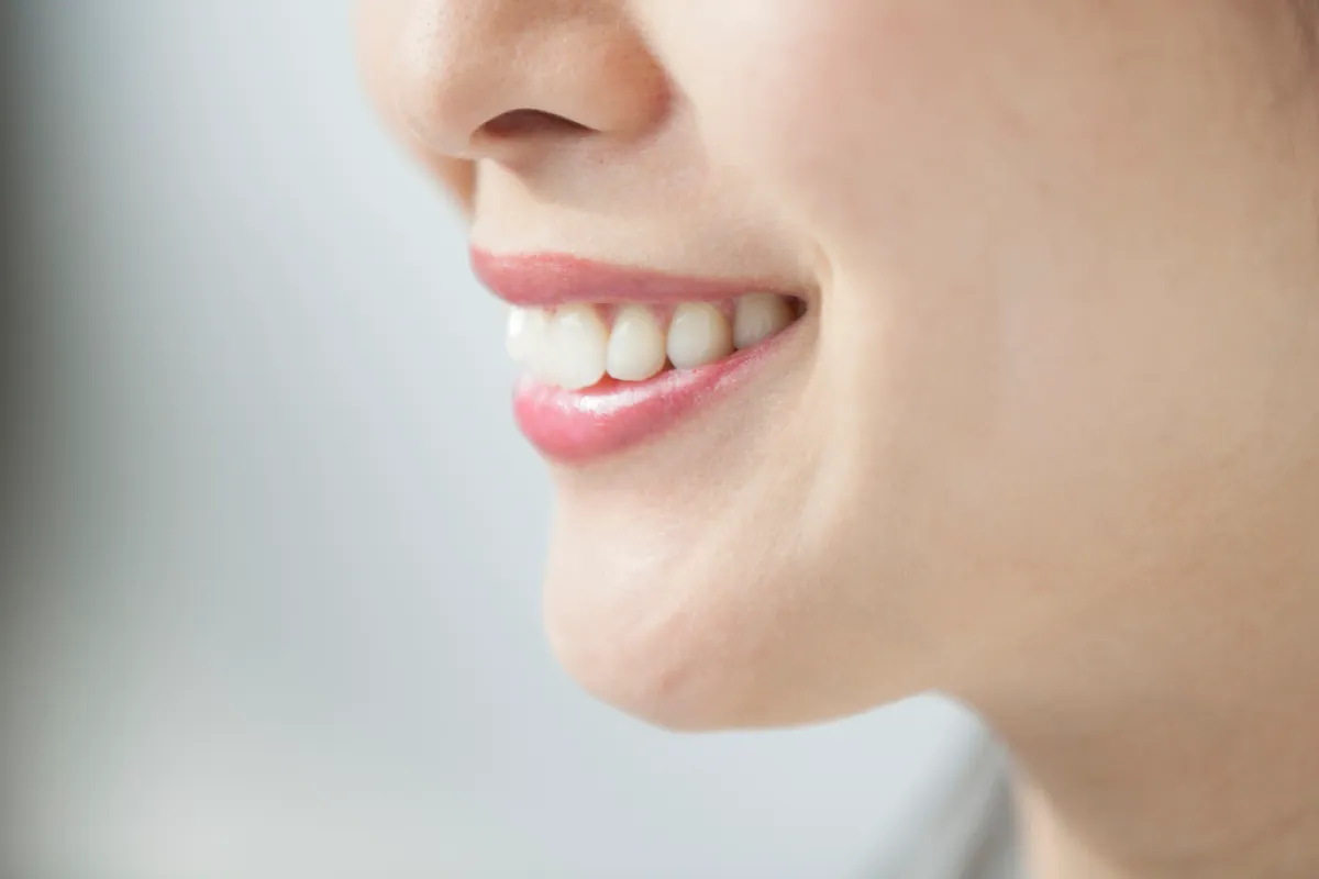 全顎矯正で歯並びが綺麗になった女性