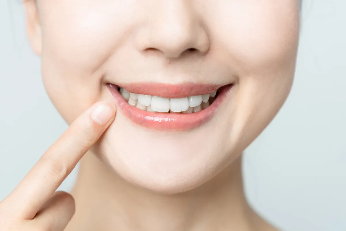 部分矯正で歯並びが綺麗になった女性