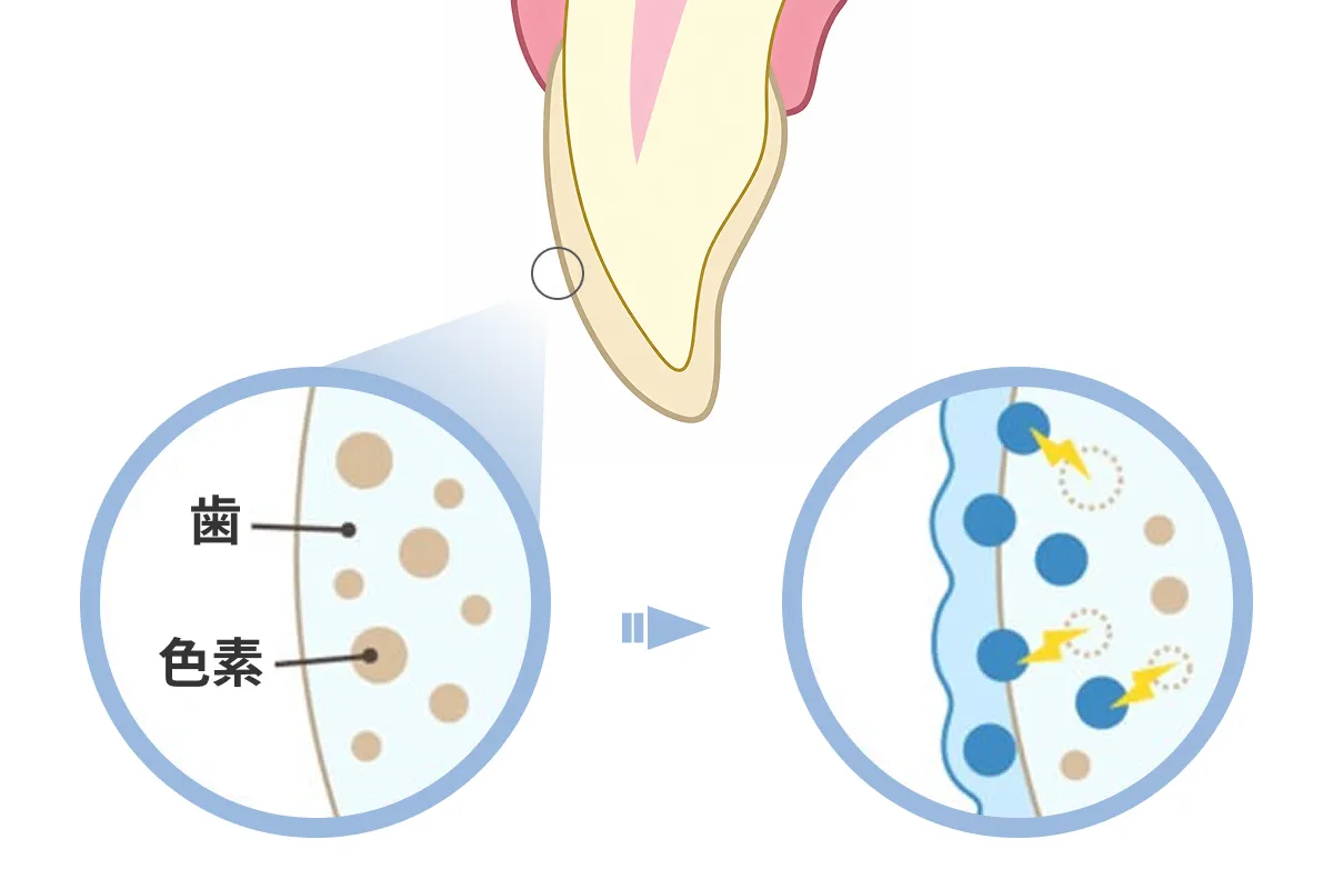 ホワイトニングで歯が白くなる仕組み