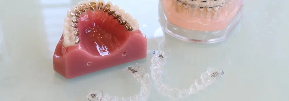 ワイヤー矯正とマウスピース矯正の画像